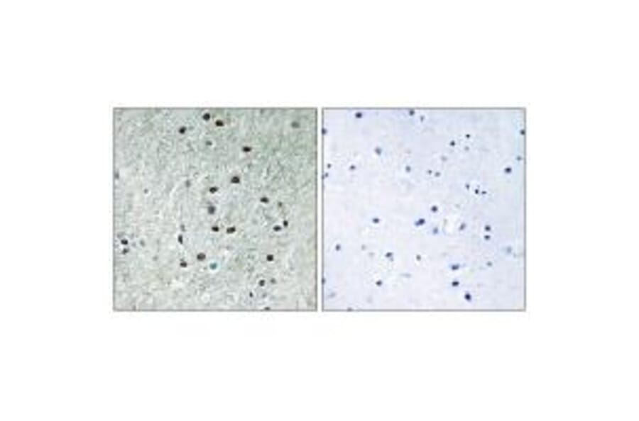 Immunohistochemistry - REXO1 Antibody from Signalway Antibody (35005) - Antibodies.com