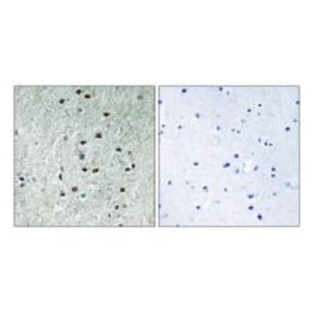 Immunohistochemistry - REXO1 Antibody from Signalway Antibody (35005) - Antibodies.com