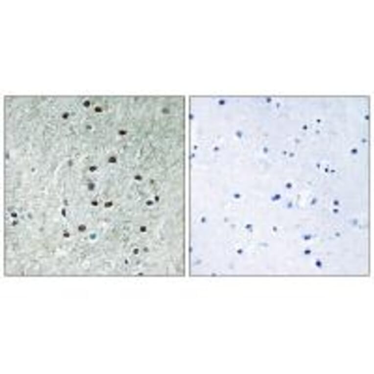 Immunohistochemistry - REXO1 Antibody from Signalway Antibody (35005) - Antibodies.com
