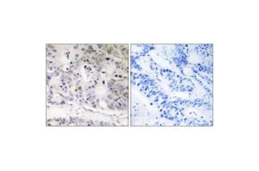 Immunohistochemistry - UBTD1 Antibody from Signalway Antibody (35126) - Antibodies.com