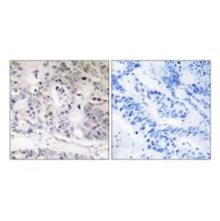 Immunohistochemistry - UBTD1 Antibody from Signalway Antibody (35126) - Antibodies.com