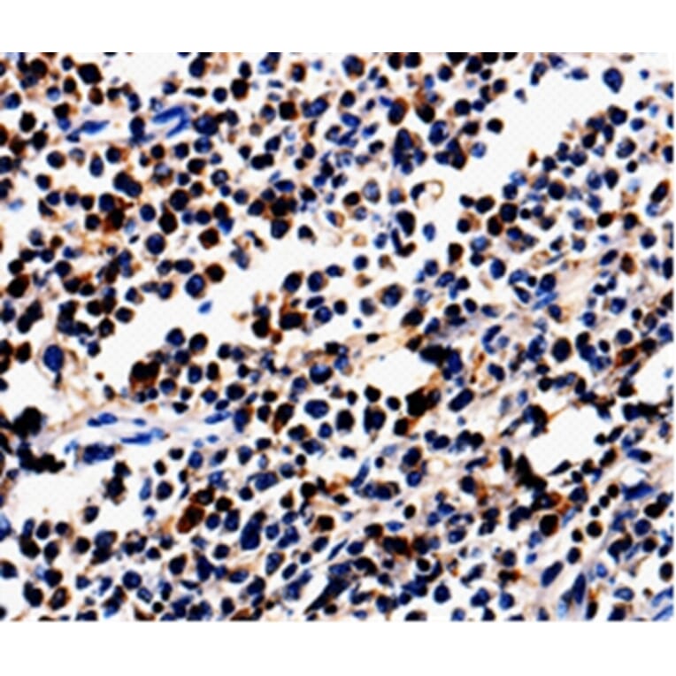 Immunohistochemistry - ALOX5 Antibody from Signalway Antibody (35564) - Antibodies.com