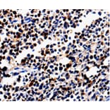 Immunohistochemistry - ALOX5 Antibody from Signalway Antibody (35564) - Antibodies.com