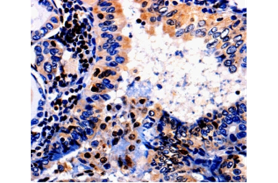 Immunohistochemistry - ALOX5 Antibody from Signalway Antibody (35564) - Antibodies.com