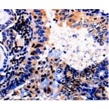 Immunohistochemistry - ALOX5 Antibody from Signalway Antibody (35564) - Antibodies.com