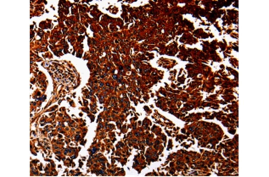 Immunohistochemistry - ANXA7 Antibody from Signalway Antibody (35568) - Antibodies.com