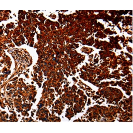 Immunohistochemistry - ANXA7 Antibody from Signalway Antibody (35568) - Antibodies.com