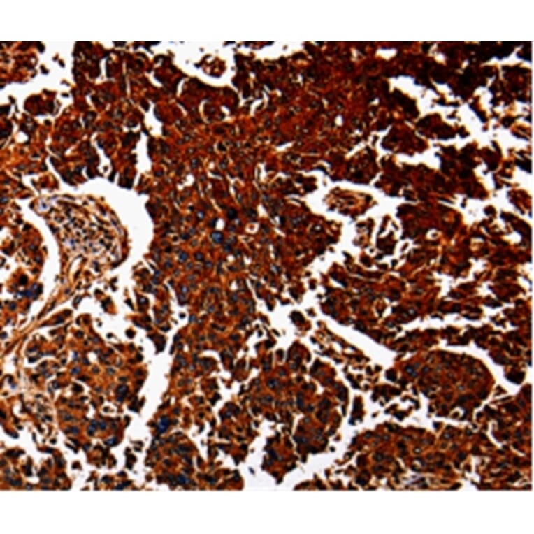 Immunohistochemistry - ANXA7 Antibody from Signalway Antibody (35568) - Antibodies.com
