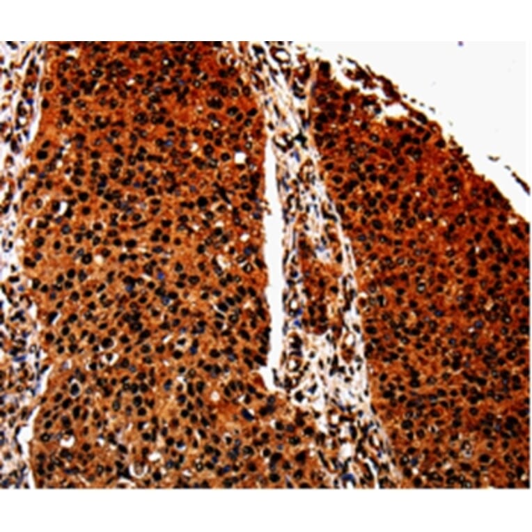 Immunohistochemistry - ANXA7 Antibody from Signalway Antibody (35568) - Antibodies.com