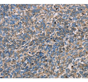 Immunohistochemistry - APOA1 Antibody from Signalway Antibody (35570) - Antibodies.com