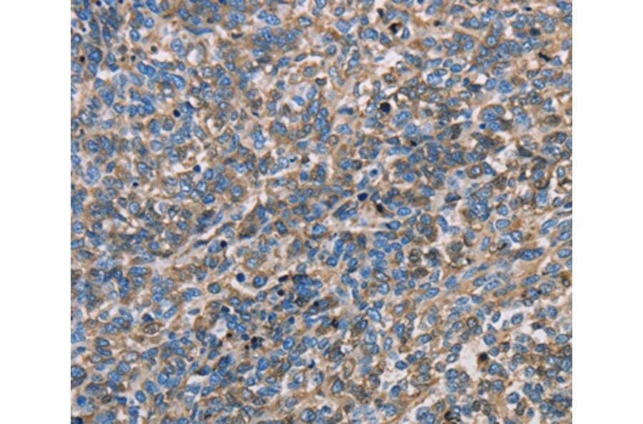 Immunohistochemistry - APOA1 Antibody from Signalway Antibody (35570) - Antibodies.com