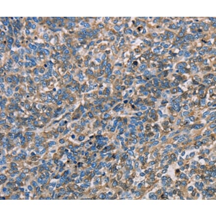 Immunohistochemistry - APOA1 Antibody from Signalway Antibody (35570) - Antibodies.com