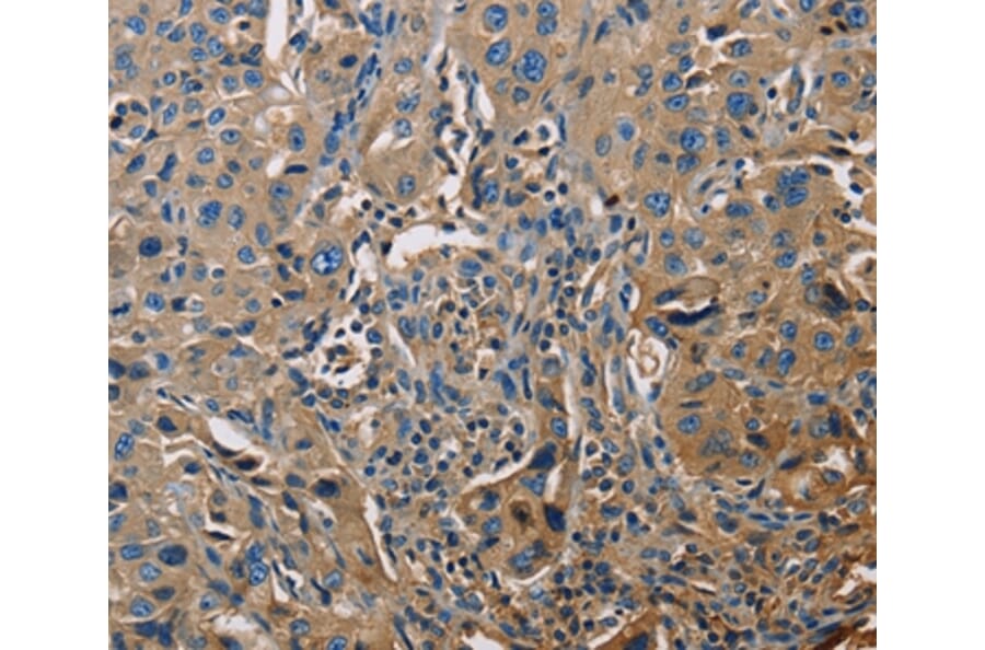 Immunohistochemistry - APOA1 Antibody from Signalway Antibody (35570) - Antibodies.com
