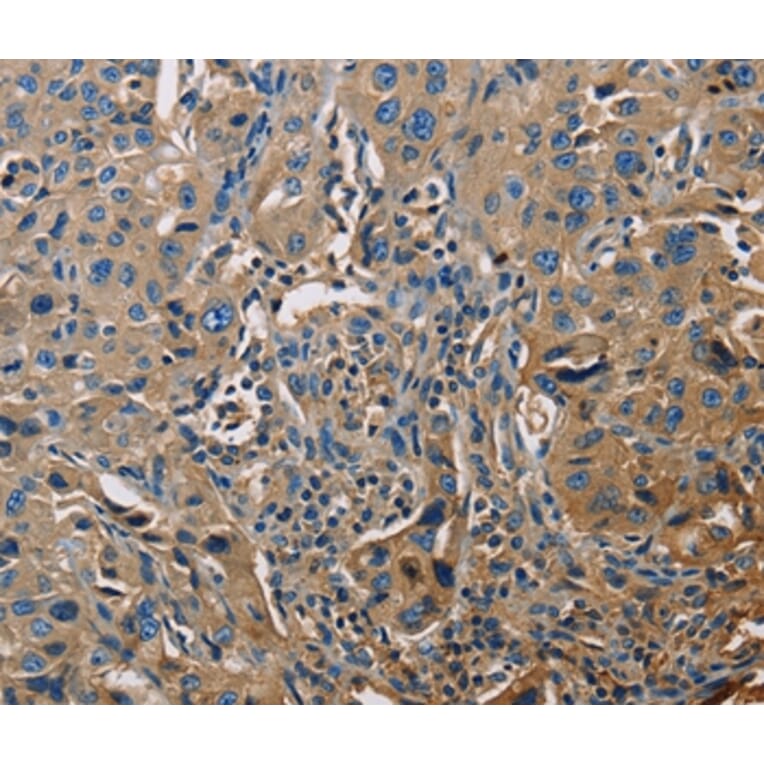 Immunohistochemistry - APOA1 Antibody from Signalway Antibody (35570) - Antibodies.com