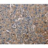 Immunohistochemistry - APOA1 Antibody from Signalway Antibody (35570) - Antibodies.com