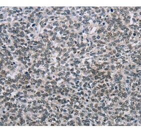 Immunohistochemistry - TONSL Antibody from Signalway Antibody (35590) - Antibodies.com