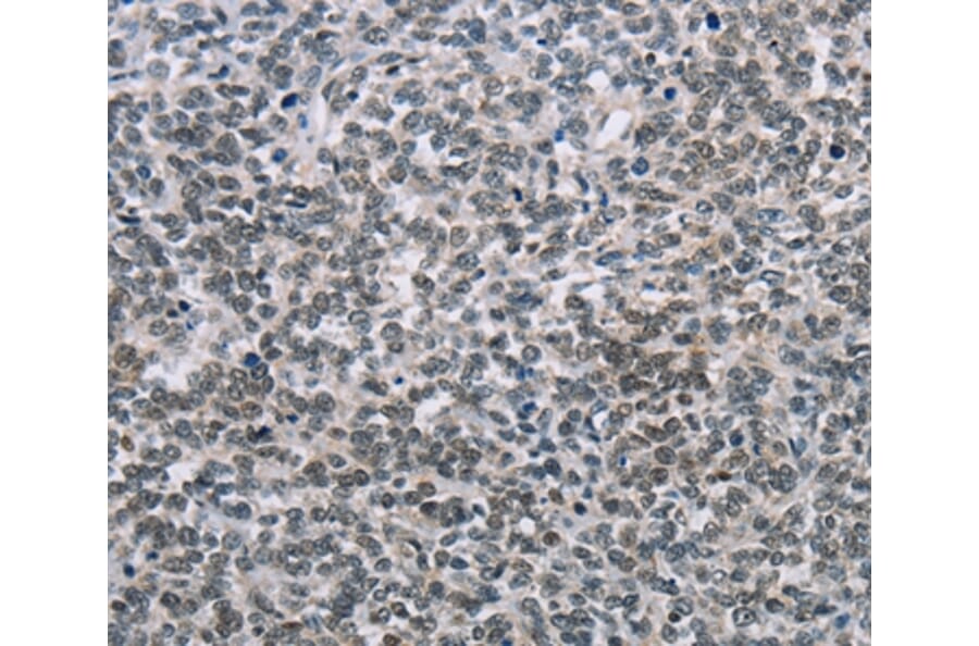 Immunohistochemistry - TONSL Antibody from Signalway Antibody (35590) - Antibodies.com
