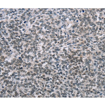 Immunohistochemistry - TONSL Antibody from Signalway Antibody (35590) - Antibodies.com