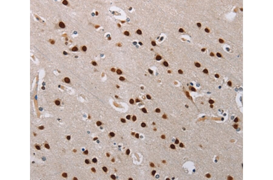 Immunohistochemistry - TONSL Antibody from Signalway Antibody (35590) - Antibodies.com