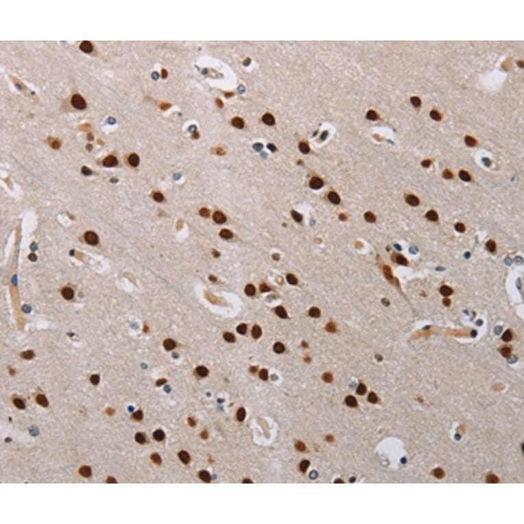 Immunohistochemistry - TONSL Antibody from Signalway Antibody (35590) - Antibodies.com