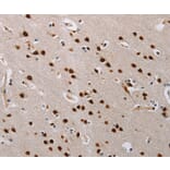 Immunohistochemistry - TONSL Antibody from Signalway Antibody (35590) - Antibodies.com