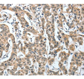 Immunohistochemistry - IL1R1 Antibody from Signalway Antibody (35604) - Antibodies.com