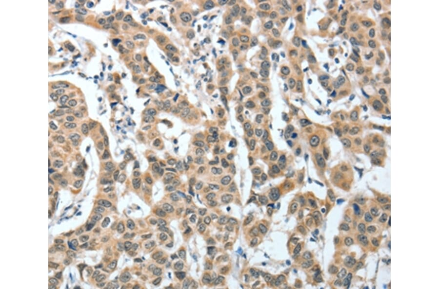 Immunohistochemistry - IL1R1 Antibody from Signalway Antibody (35604) - Antibodies.com