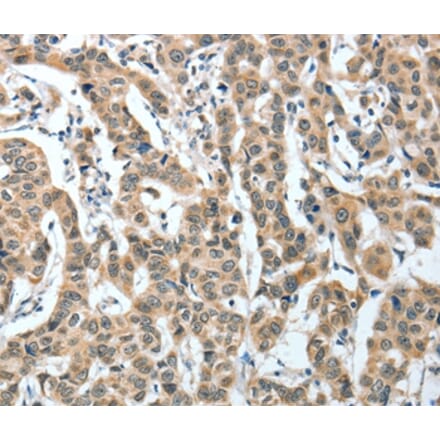 Immunohistochemistry - IL1R1 Antibody from Signalway Antibody (35604) - Antibodies.com