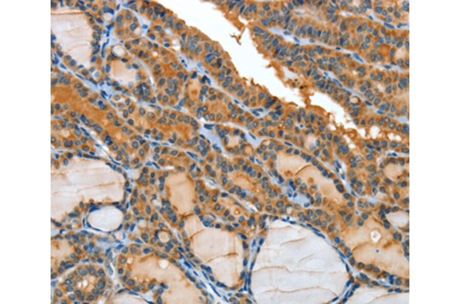 Immunohistochemistry - IL1R1 Antibody from Signalway Antibody (35604) - Antibodies.com