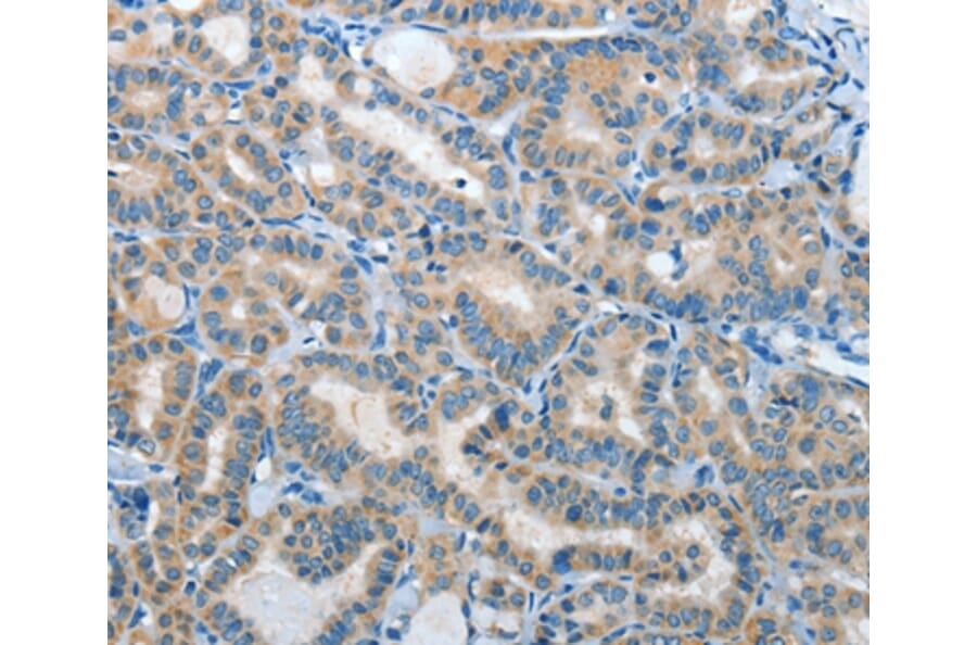Immunohistochemistry - IL21R Antibody from Signalway Antibody (35607) - Antibodies.com