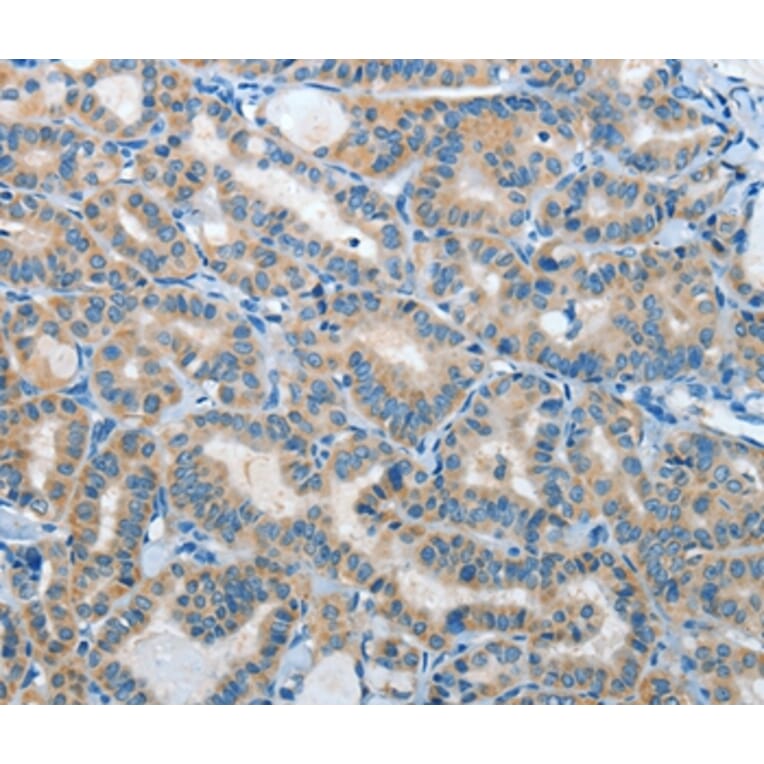 Immunohistochemistry - IL21R Antibody from Signalway Antibody (35607) - Antibodies.com