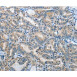Immunohistochemistry - IL21R Antibody from Signalway Antibody (35607) - Antibodies.com