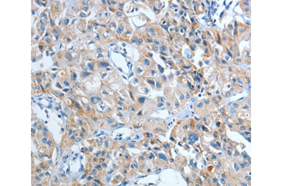 Immunohistochemistry - IL21R Antibody from Signalway Antibody (35607) - Antibodies.com