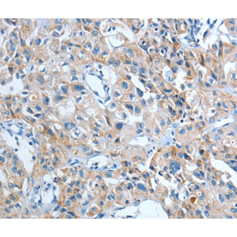 Immunohistochemistry - IL21R Antibody from Signalway Antibody (35607) - Antibodies.com