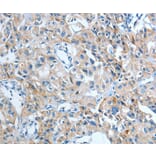 Immunohistochemistry - IL21R Antibody from Signalway Antibody (35607) - Antibodies.com