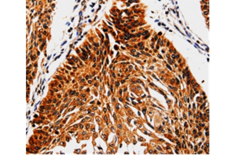 Immunohistochemistry - ABCB5 Antibody from Signalway Antibody (35612) - Antibodies.com