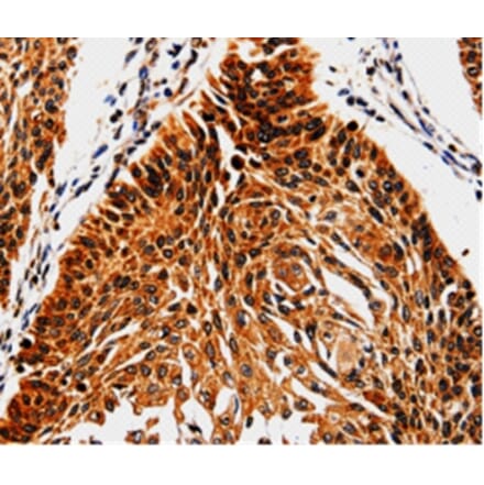 Immunohistochemistry - ABCB5 Antibody from Signalway Antibody (35612) - Antibodies.com