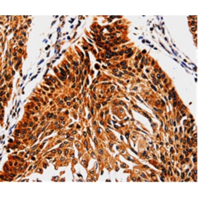 Immunohistochemistry - ABCB5 Antibody from Signalway Antibody (35612) - Antibodies.com