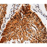 Immunohistochemistry - ABCB5 Antibody from Signalway Antibody (35612) - Antibodies.com