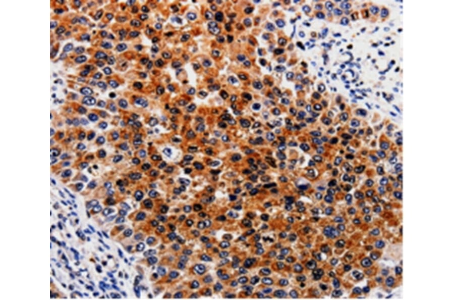 Immunohistochemistry - ABCB5 Antibody from Signalway Antibody (35612) - Antibodies.com