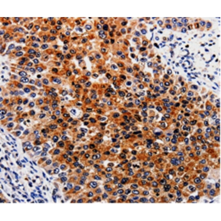Immunohistochemistry - ABCB5 Antibody from Signalway Antibody (35612) - Antibodies.com