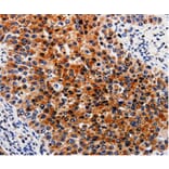 Immunohistochemistry - ABCB5 Antibody from Signalway Antibody (35612) - Antibodies.com