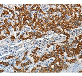 Immunohistochemistry - KRT18 Antibody from Signalway Antibody (35624) - Antibodies.com