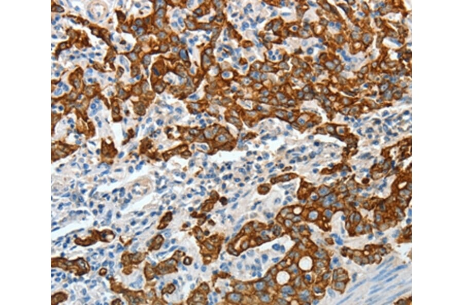 Immunohistochemistry - KRT18 Antibody from Signalway Antibody (35624) - Antibodies.com