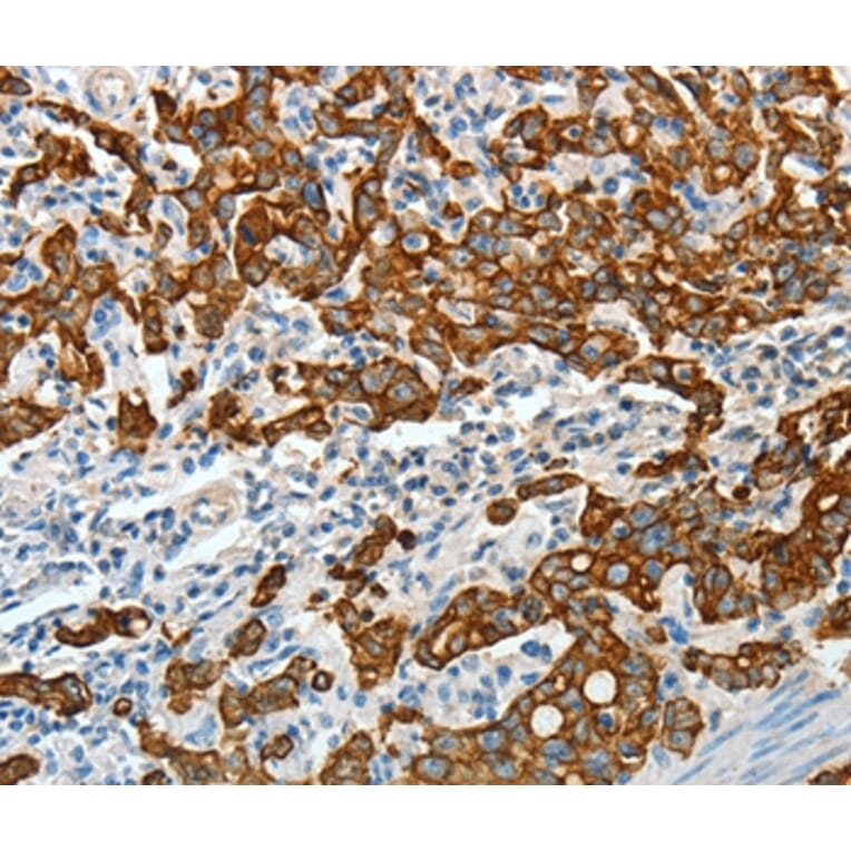 Immunohistochemistry - KRT18 Antibody from Signalway Antibody (35624) - Antibodies.com