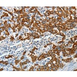 Immunohistochemistry - KRT18 Antibody from Signalway Antibody (35624) - Antibodies.com