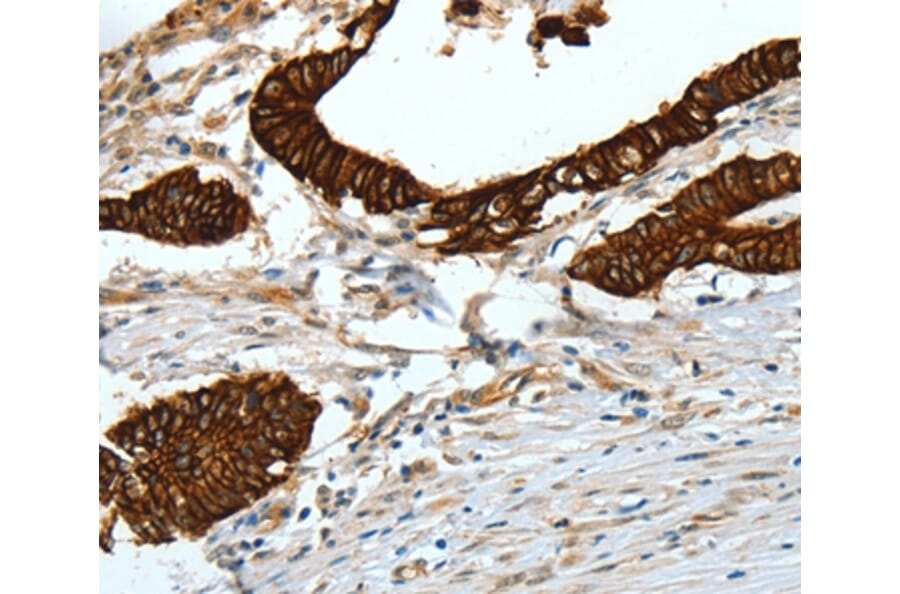 Immunohistochemistry - KRT18 Antibody from Signalway Antibody (35624) - Antibodies.com