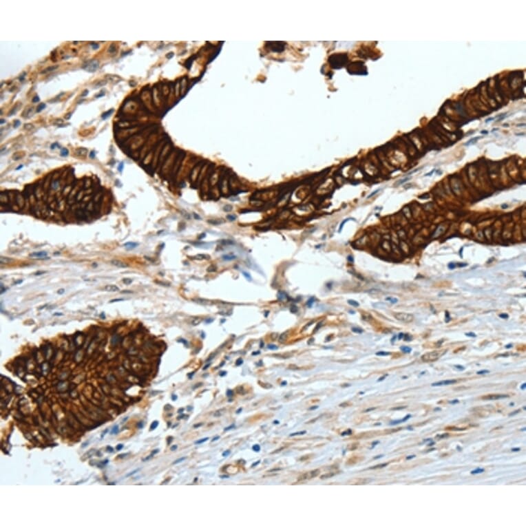 Immunohistochemistry - KRT18 Antibody from Signalway Antibody (35624) - Antibodies.com