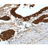 Immunohistochemistry - KRT18 Antibody from Signalway Antibody (35624) - Antibodies.com