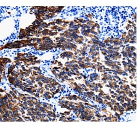 Immunohistochemistry - KRT6A Antibody from Signalway Antibody (35628) - Antibodies.com